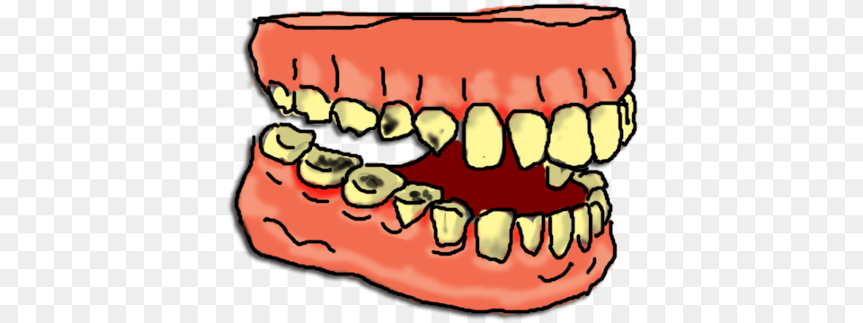 Library Of Waffle With Mouth Banner Stock Files Tooth Decay Clipart, Body Part, Person, Teeth, Face Free Png Download