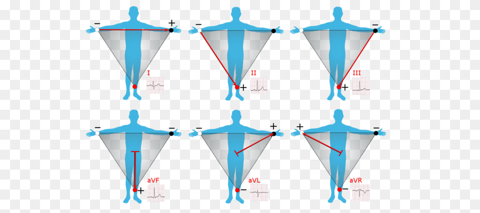 Limb Leads Of Ekg, Chart, Plot, Adult, Female Png Image