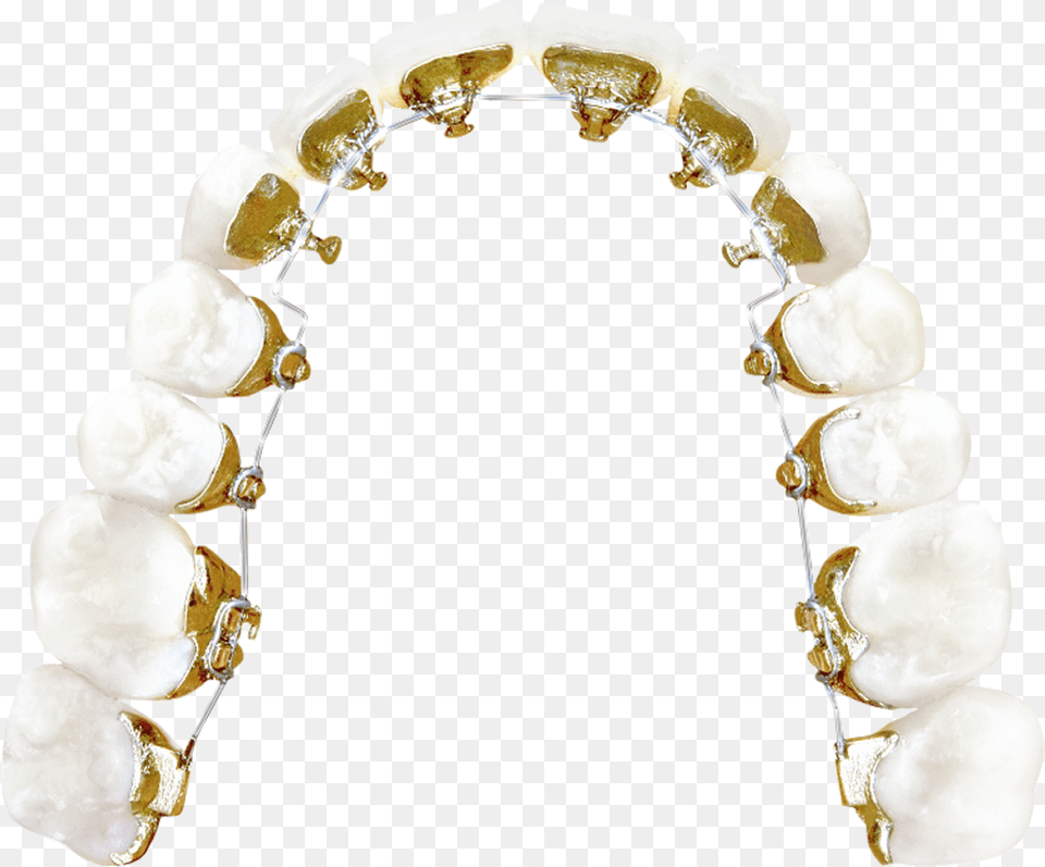 Lingual Braces Pearl, Accessories, Body Part, Mouth, Teeth Png Image