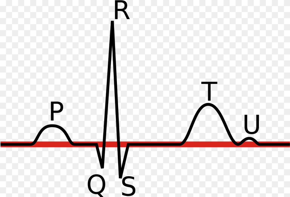 Linia Izoelektryczna Ekg Popis Ekg Free Png