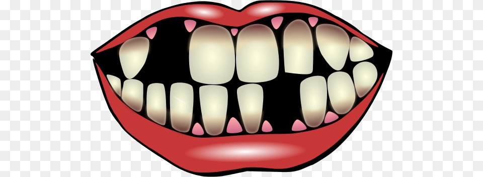 Lips Clipart, Body Part, Mouth, Person, Teeth Free Png Download