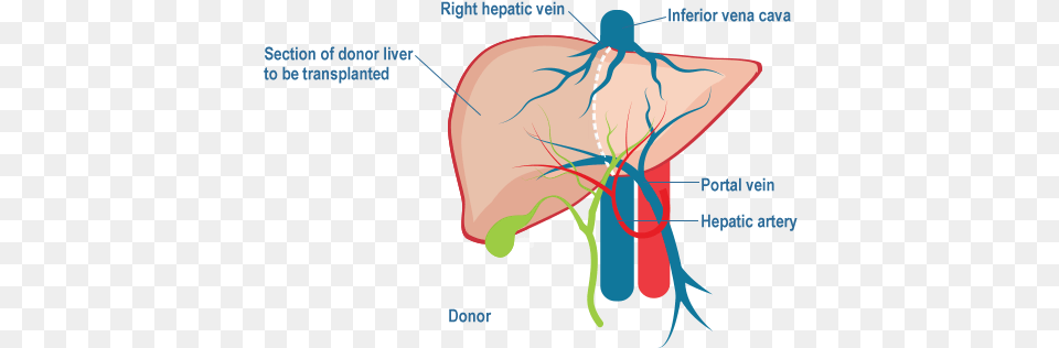 Live Donor Liver Transplantation Liver Transplantation, Body Part, Face, Head, Neck Free Png Download
