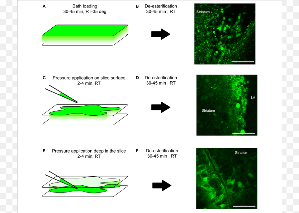 Loading Protocol Of Calcium Indicator Dyes Brain Slice Calcium Imaging, Accessories, Gemstone, Jewelry, Green Free Png Download