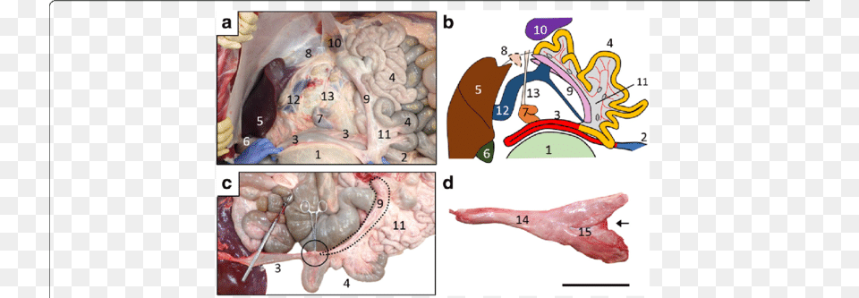 Location Of Organs Surrounding Pancreas And Morphology Organ, Baby, Person, Head Free Png Download