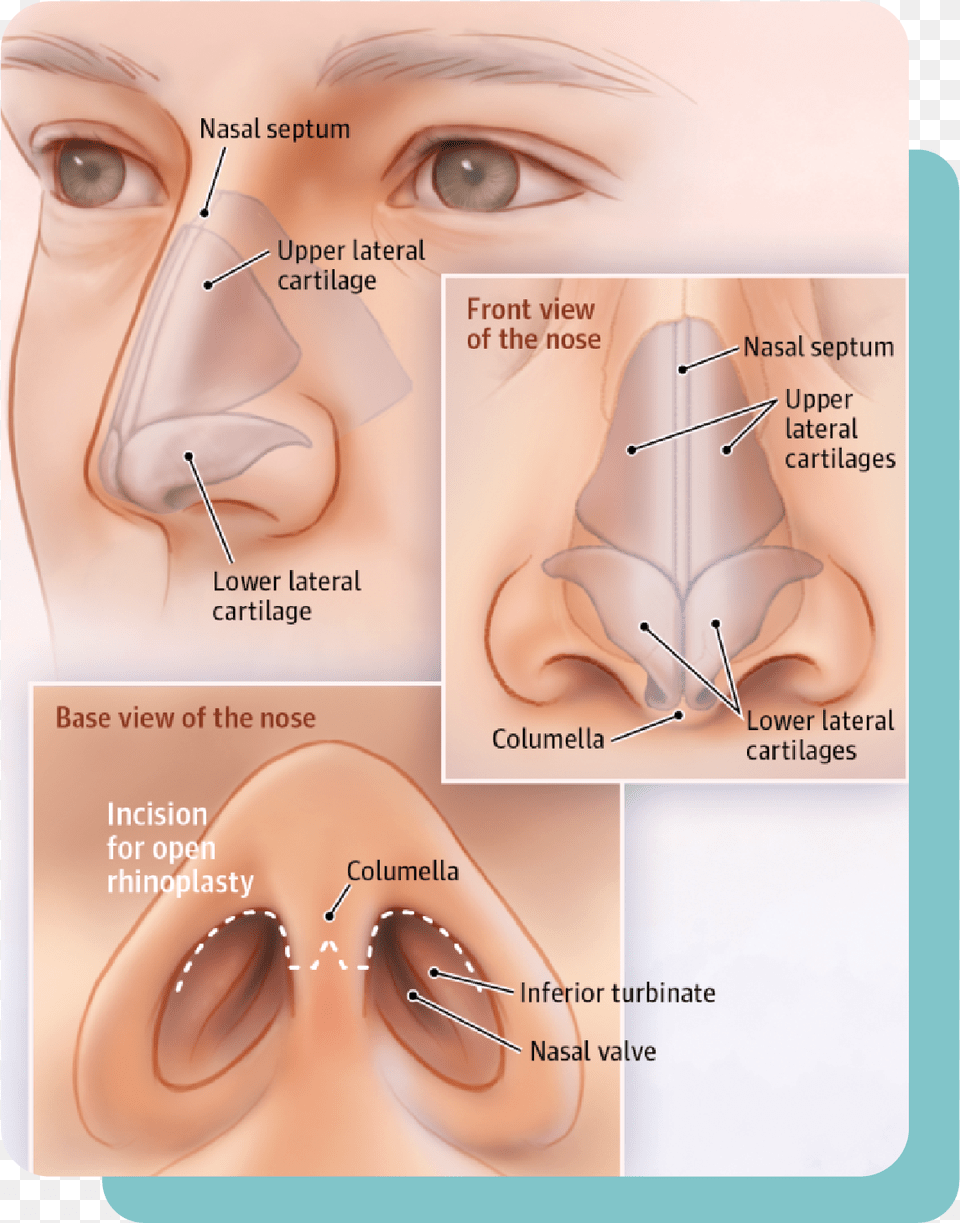 Lower Lateral Cartilage Nose Job, Body Part, Face, Head, Neck Free Transparent Png