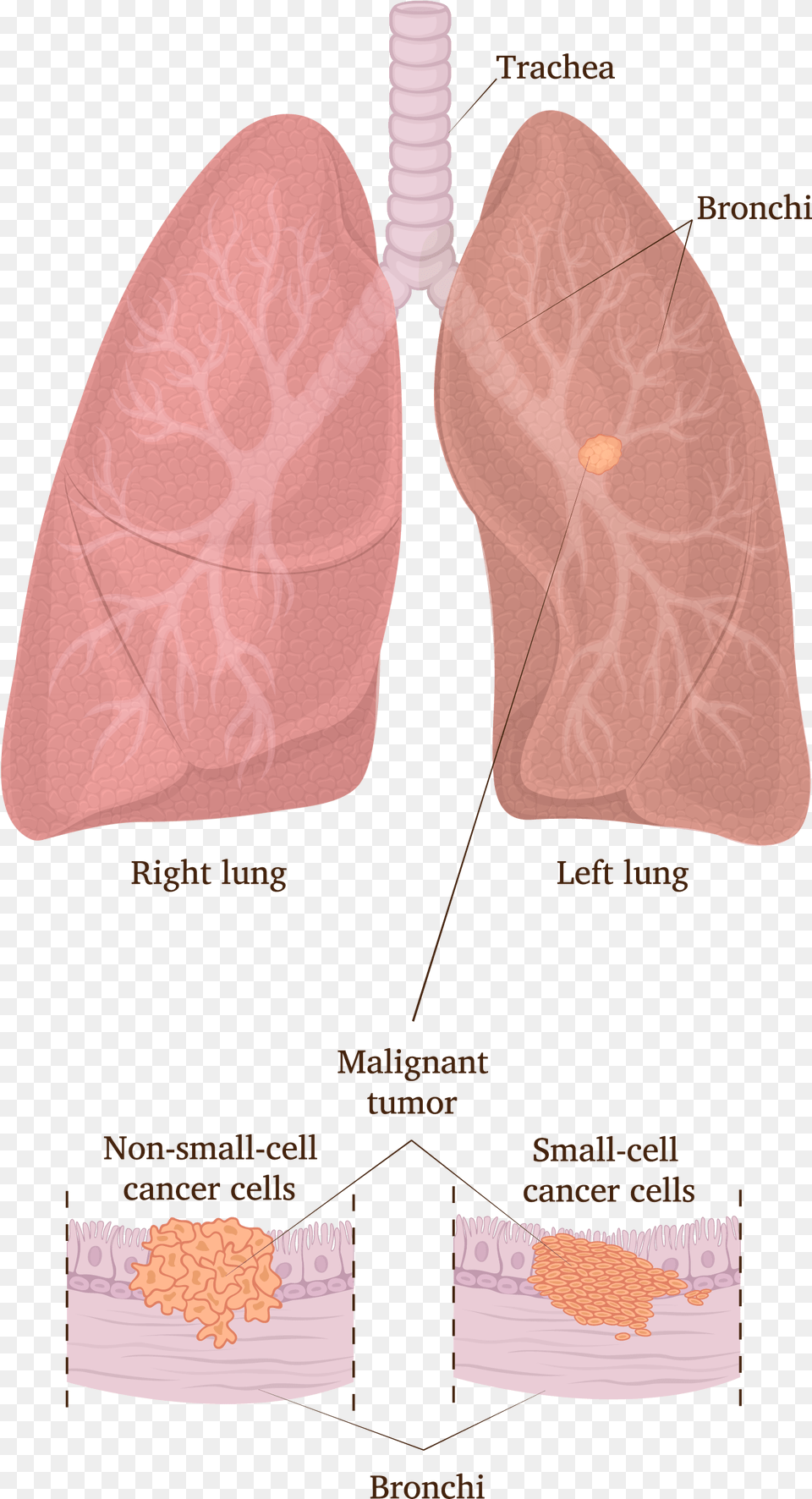 Lung, Face, Head, Person Free Png Download