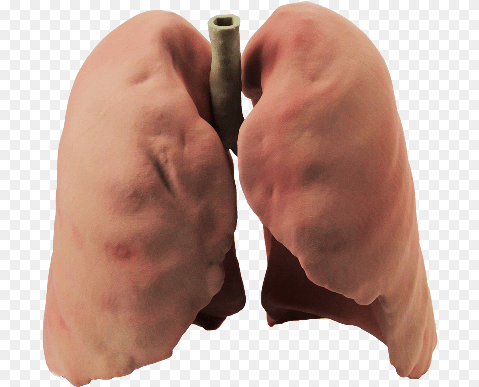 Lung, Adult, Male, Man, Person Png Image