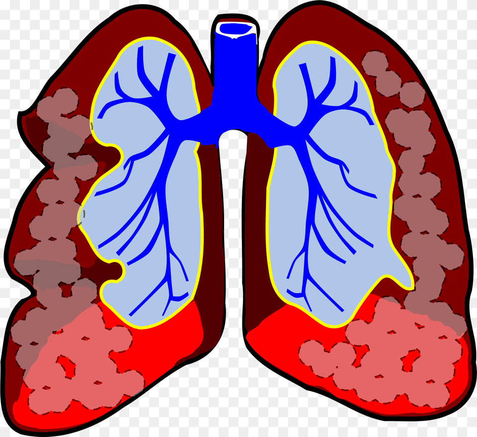 Lungs Clipart, Ct Scan, Flower, Plant, Heart Png