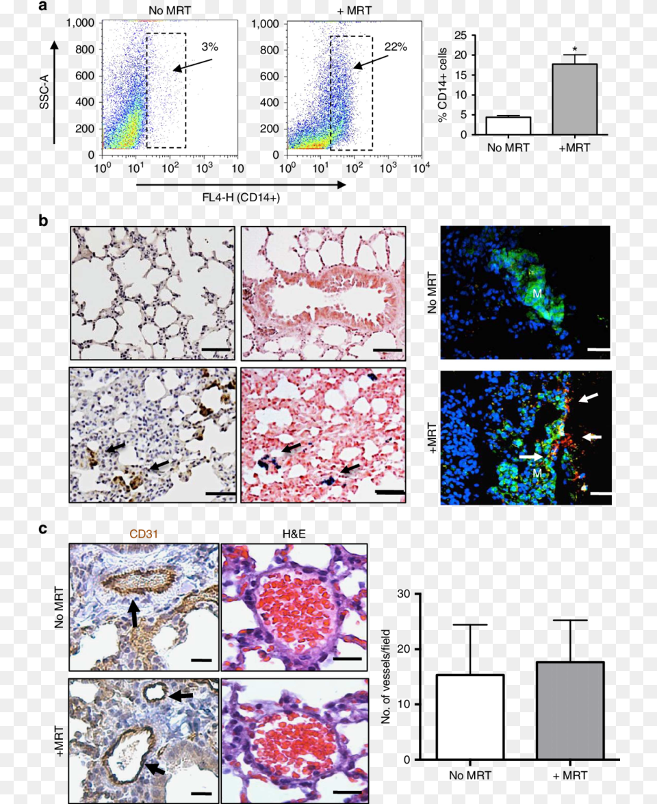 Magnetic Macrophages Were Steered Into Pulmonary Metastasis, Art, Collage, Pattern Free Png Download