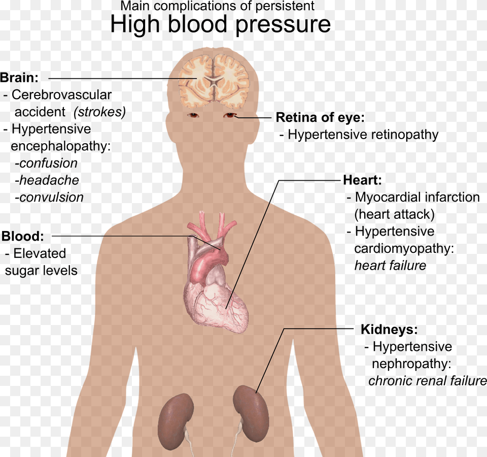 Main Complications Of Persistent High Blood Pressure High Blood Pressure Nails, Adult, Female, Person, Woman Free Transparent Png