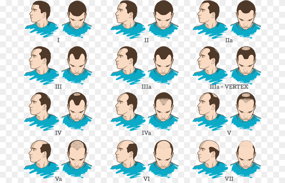 Male Pattern Baldness Team, Person, Book, Water Sports, Water Free Png