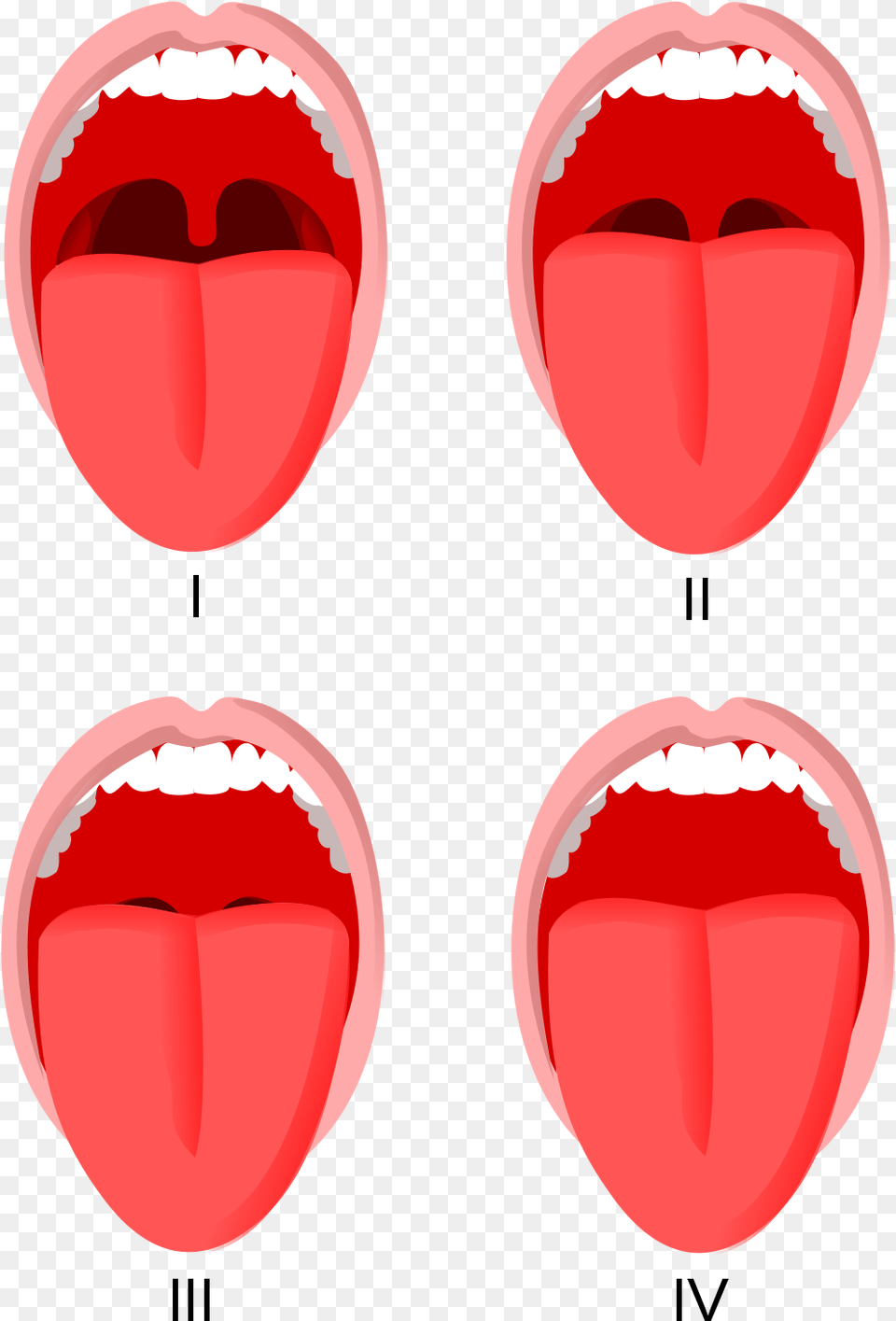 Mallampati, Body Part, Mouth, Person, Tongue Free Png Download