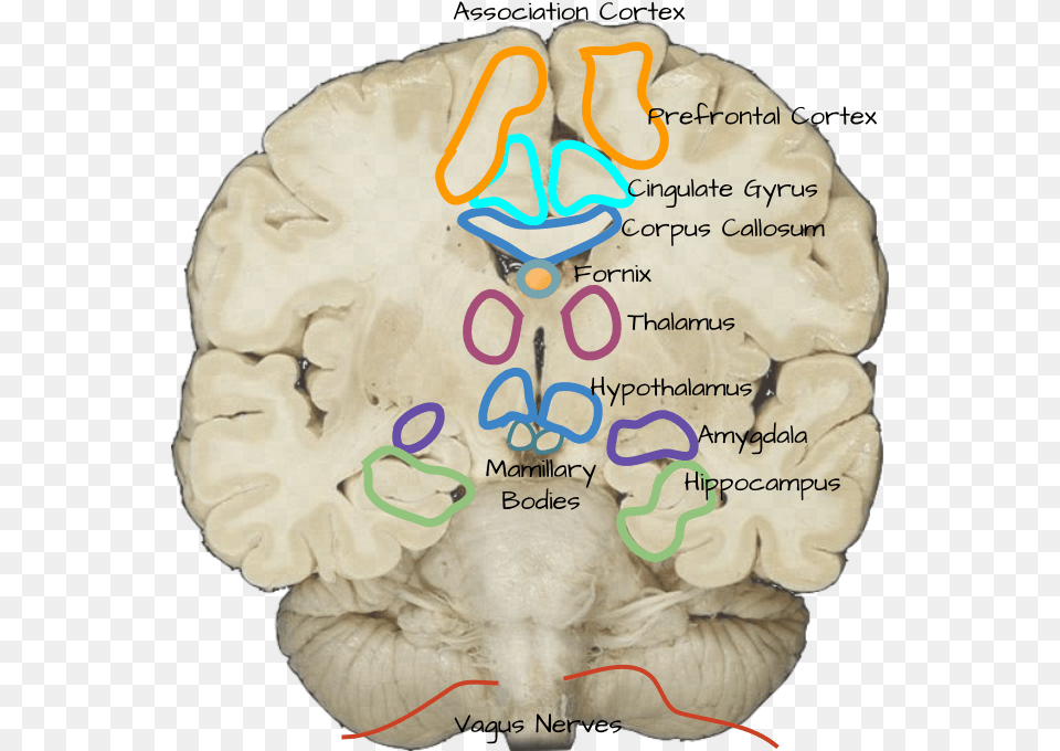 Mamillary Bodies On Cadaver, Ct Scan, Head, Person, Face Free Transparent Png