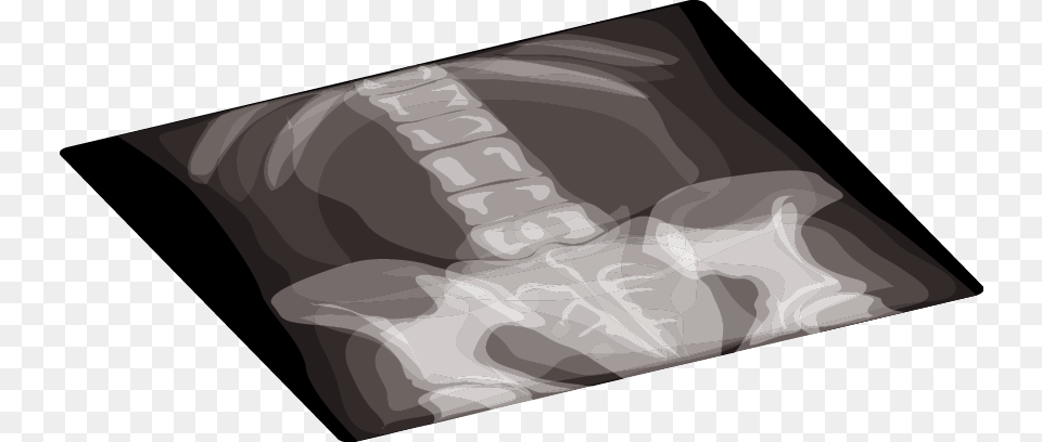 Medical Equipment Clipart Radiology, X-ray, Animal, Fish, Sea Life Png Image