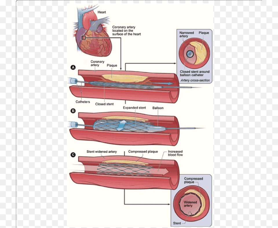 Medication Of Heart Disease Free Transparent Png