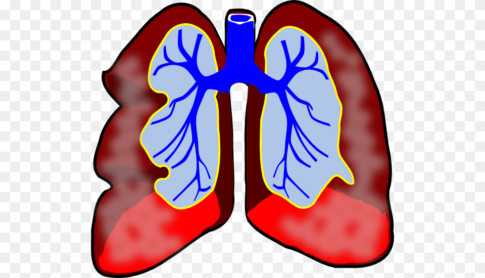 Mesothelioma Clip Art, Heart, Ct Scan, Dynamite, Weapon Free Transparent Png