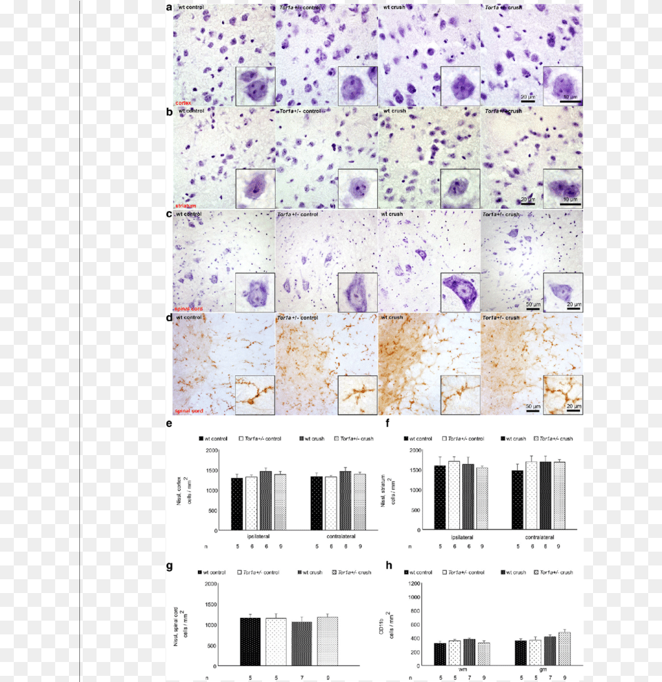 Mice Do Not Present Morphological Changes In Spinal Cord, Text Free Png