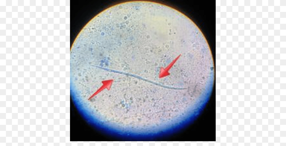 Microfilariae In The Modified Knott Test Smear Fig Adult, Sphere, Astronomy, Moon, Nature Png Image
