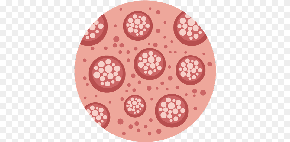 Microscopic Colitis Madurai, Home Decor, Disk, Pattern, Face Png Image
