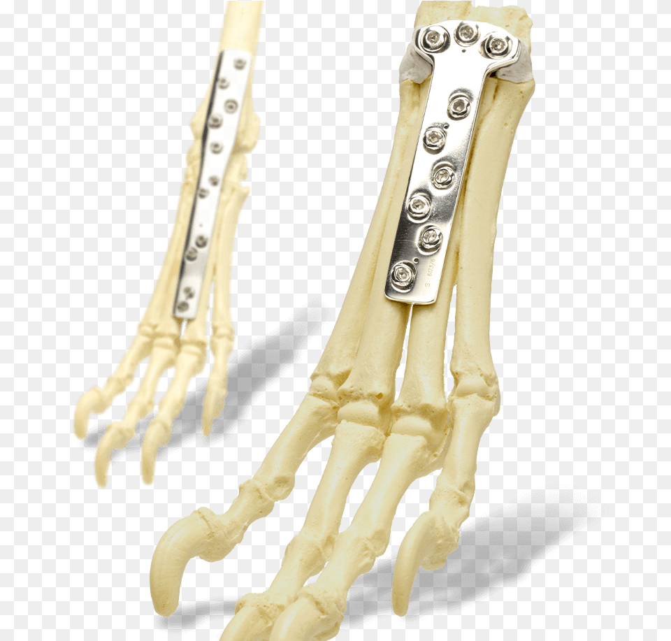 Mmp Sop Ridgestop Carpal Arthodesis Bone, Electronics, Hardware Free Png Download