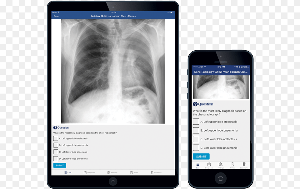 Module Title X Ray, Electronics, Mobile Phone, Phone, Adult Free Png Download