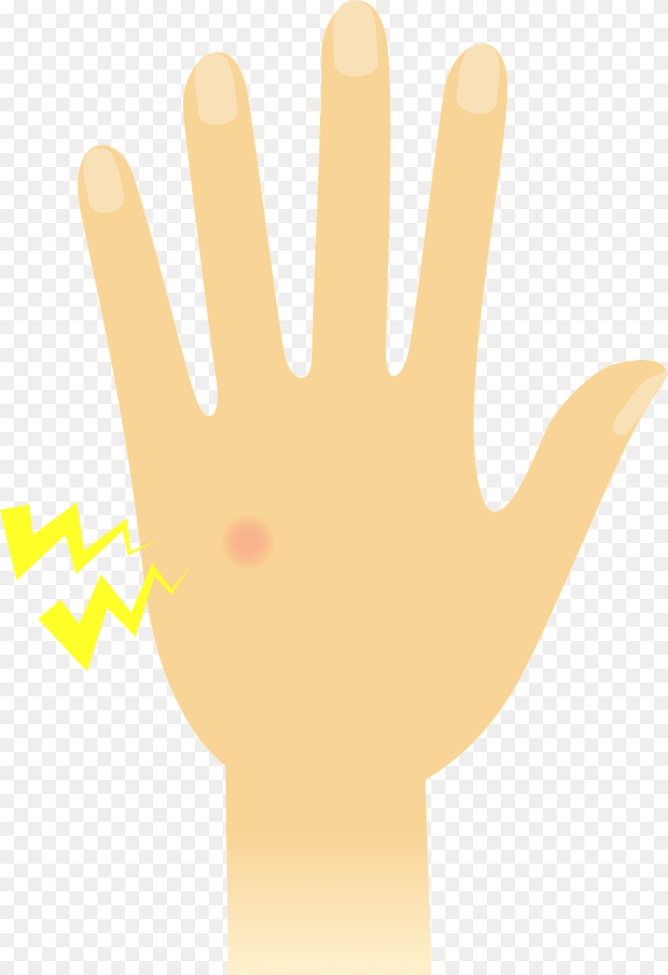 Mosquito Bite On A Hand Clipart, Wrist, Person, Glove, Finger Free Png