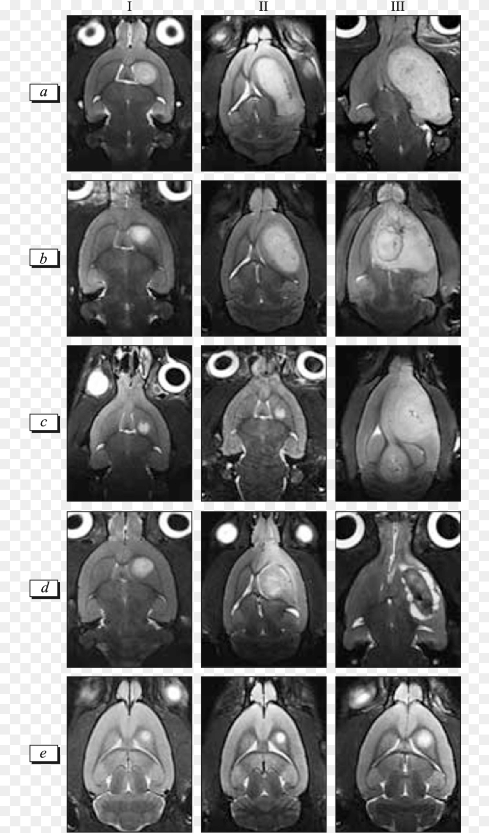 Mrt Of Rats With C6 Experimental Glioma After Combination Therapy, Ct Scan, Baby, Person, Adult Free Png