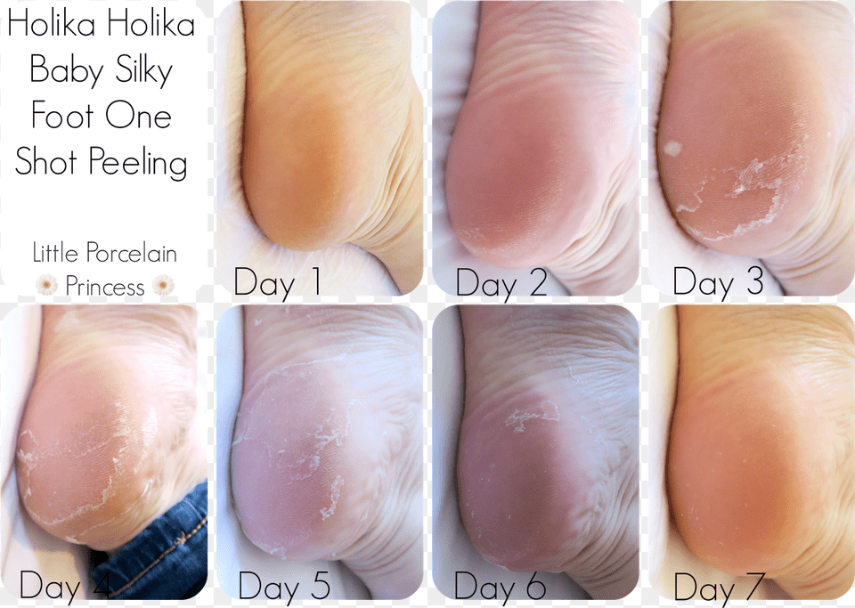 My Feet Did Peel Lightly For A Couple Of Days After Skin Republic Foot Peel Review, Body Part, Heel, Person, Baby Png Image