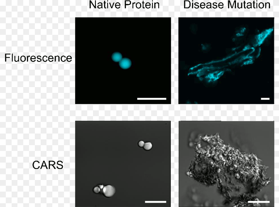 Native And Disease Mutated Rnp Granule Proteins Micrometre, Water, Sea, Outdoors, Nature Free Png