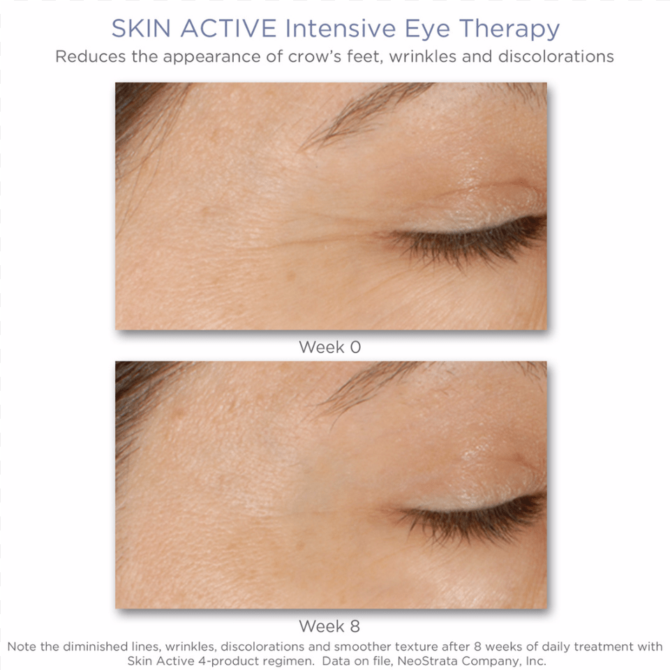 Neostrata Skin Active Intensive Eye Therapy Neostrata Skin Active Eye Therapy, Body Part, Face, Head, Neck Png