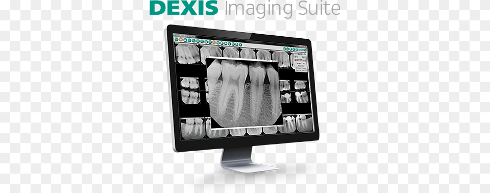 Next Generation Software Architecture Digital Radiography, Hardware, Computer Hardware, Electronics, Screen Free Transparent Png