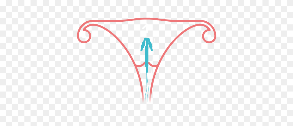 Non Hormonal Coil Information, Clothing, Lingerie, Underwear, Panties Png Image