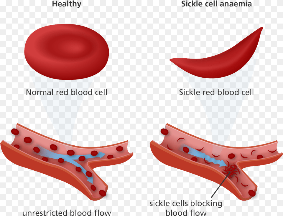 Normal Red Blood Cell And Sickle Cell, Appliance, Ceiling Fan, Device, Electrical Device Free Transparent Png
