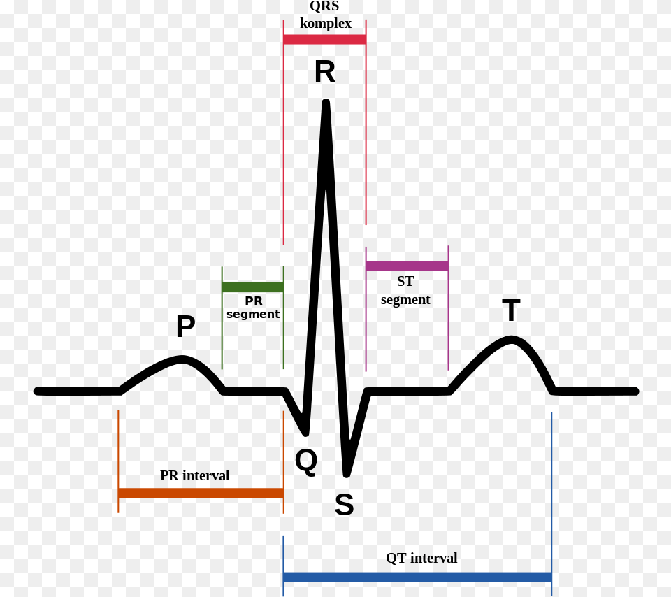 Normal Sinus Rhythm, Diagram Png