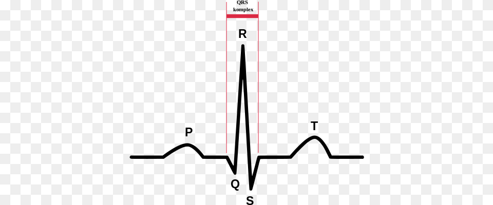 Normal Sinus Rhythm Free Png