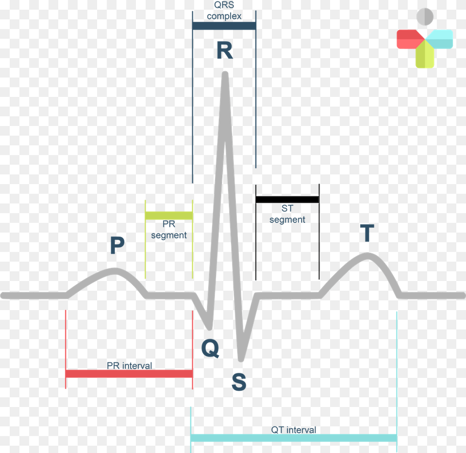 Normal Sinus Rhythm Labeled, Chart, Plot Png Image