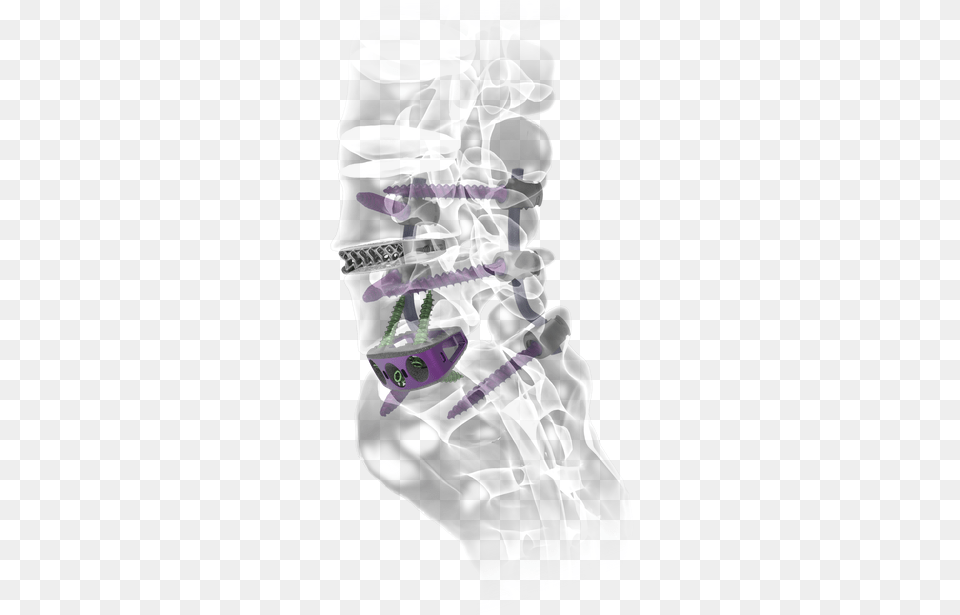 Nuvasive Precept, Baby, Person Png Image