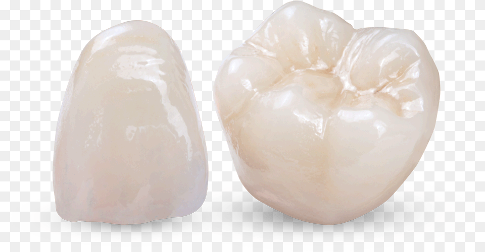 Obsidian All Ceramic Restorations For Bridges Crowns Tooth, Body Part, Mouth, Person, Teeth Png Image