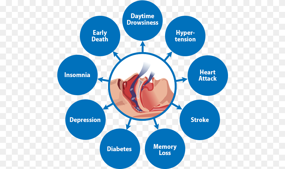 Obstructive Sleep Apnea Risks, Architecture, Building, Hospital, Face Free Png