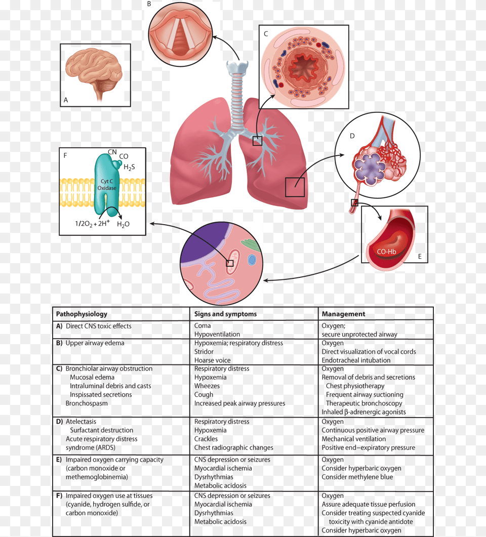 Occupational And Environmental Toxins Diagram, Clothing, Hat Free Png Download