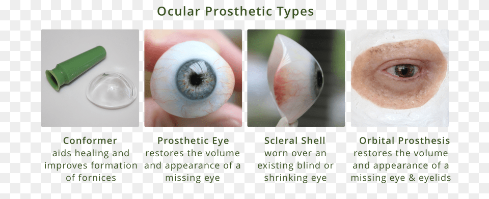 Ocular Prosthesis Types Diagram Types Of Eye Prosthesis, Animal, Insect, Invertebrate, Face Free Png