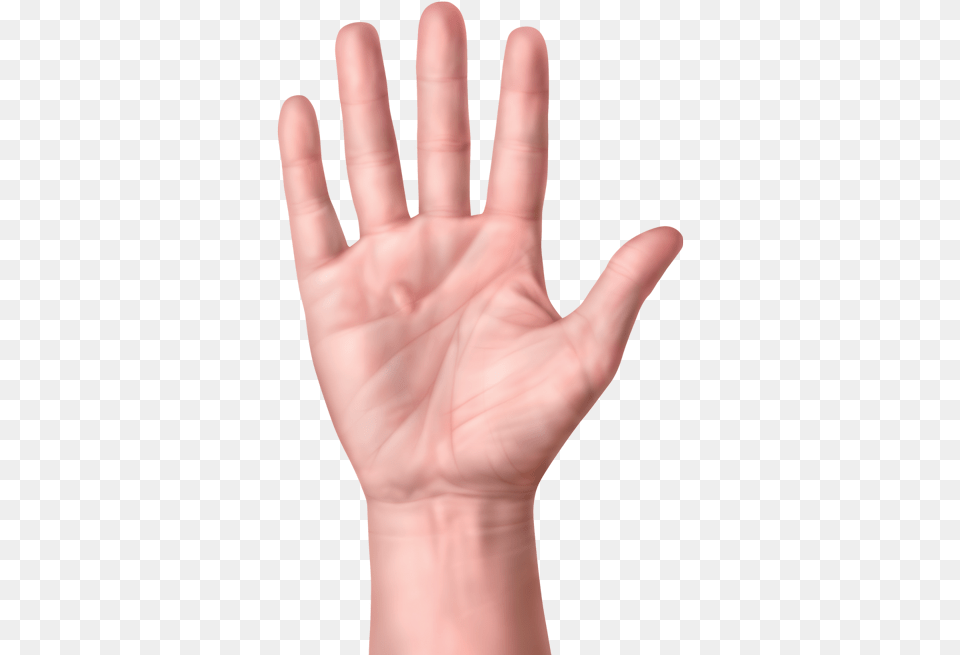 One Hand With Nodules Or Lump In Palm Of Hand Hand Dupuytren39s Contracture, Body Part, Finger, Person, Wrist Free Transparent Png