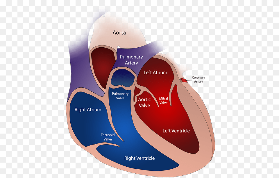 Open Heart, Ct Scan, Diagram, Adult, Female Free Png