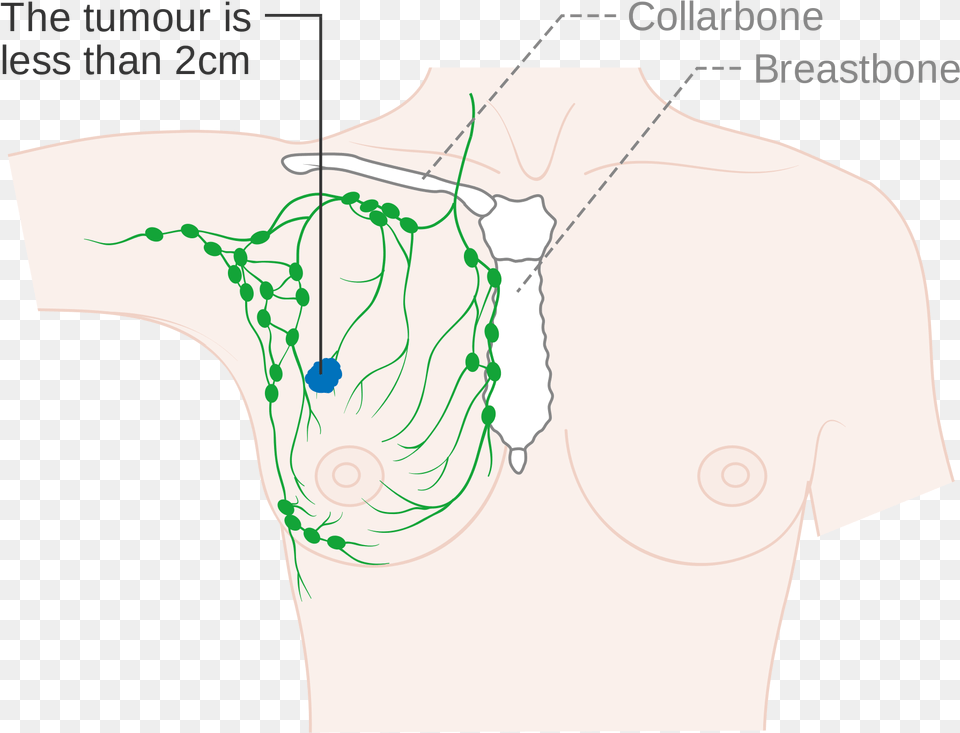 Open Lymph Nodes On Collar Bones, Accessories, Chart, Plot, Adult Png Image