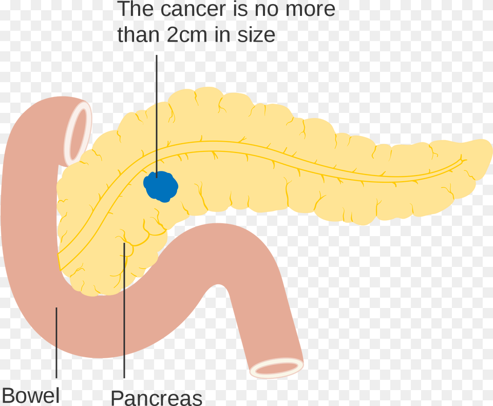 Open Pancreas Svg, Body Part, Stomach, Chandelier, Lamp Free Png