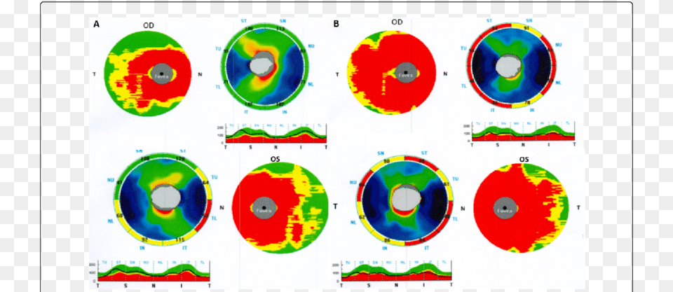 Optic Coherence Tomography, Text Png Image