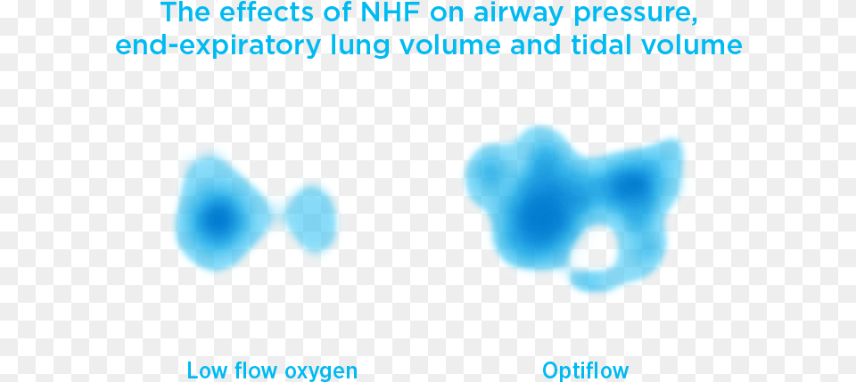 Optiflow High Flow Pressure Mechanism Overview Teddy Bear, Ice, Nature, Outdoors Free Png Download