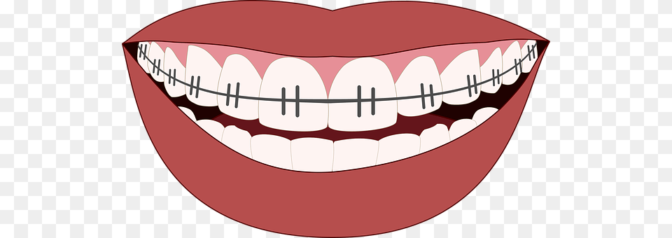 Orthodontics Body Part, Mouth, Person, Teeth Png Image