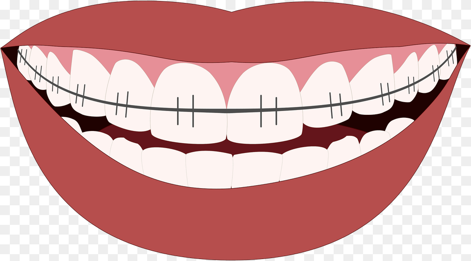 Orthodontics Clipart, Person, Body Part, Teeth, Mouth Free Png Download