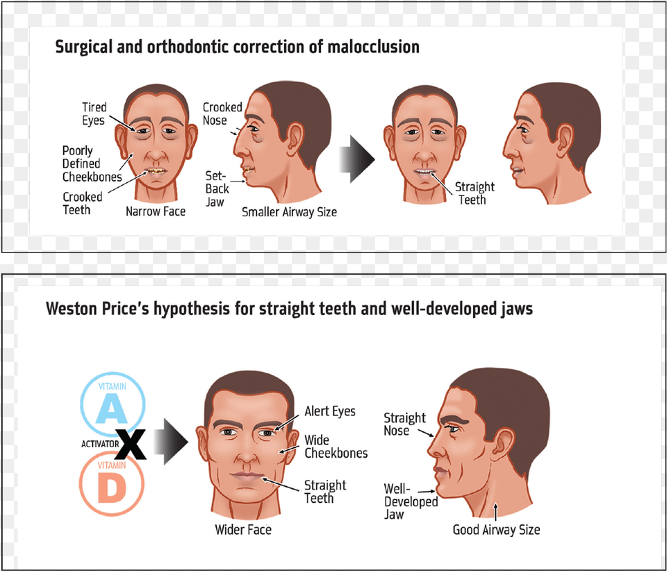 Orthotown Magazine, Adult, Person, Neck, Head Png Image